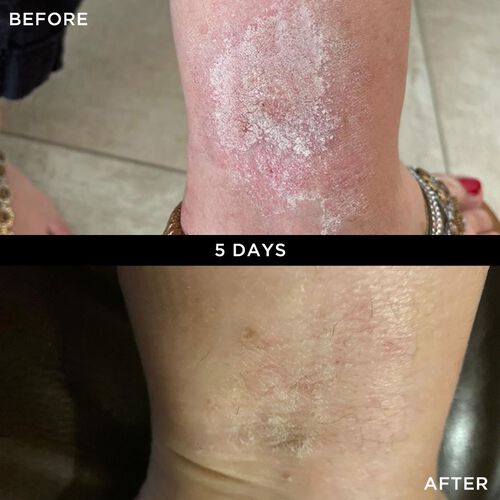 BeautyPro Wonderbalm 50ml