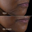 Clinique Clinique Smart Clinical Repair™ Lifting Face + Neck Cream 50ml