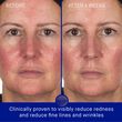Augustinus Bader The Hydrogel Face Mask