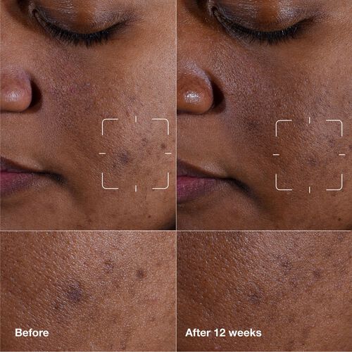 Clinique Even Better Clinical™ Dark Spot Clearing Serum 30ml