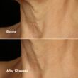 Clinique Clinique Smart Clinical Repair™ Lifting Face + Neck Cream 50ml