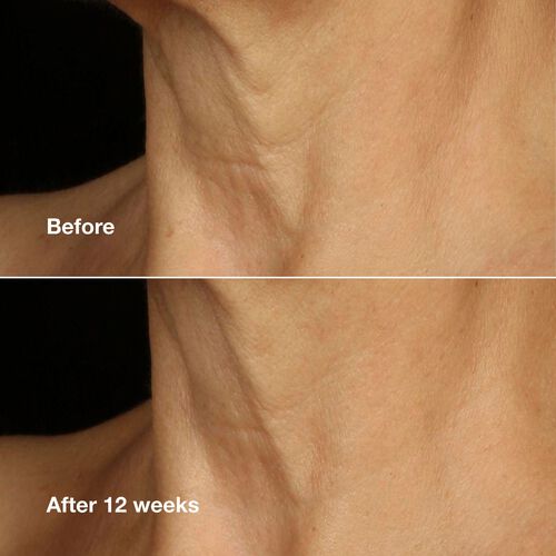 Clinique Clinique Smart Clinical Repair™ Lifting Face + Neck Cream 50ml