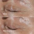 Clinique Smart Clinical Repair Eye Cream 15ml