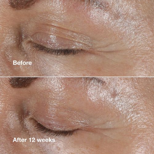 Clinique Smart Clinical Repair Eye Cream 15ml